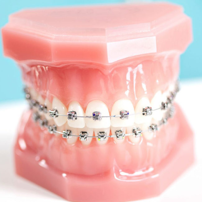 Orthodontic Dental Nursing