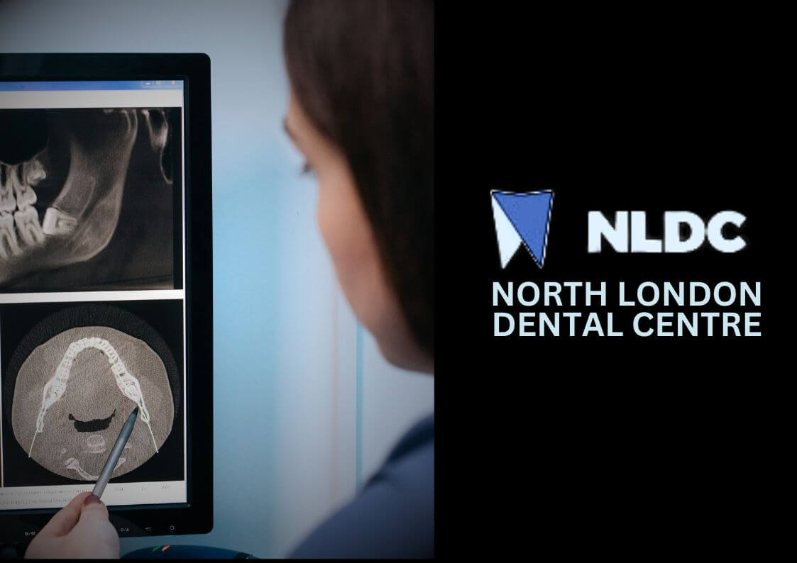 Accredited Online Dental Nurse Course from NLDC