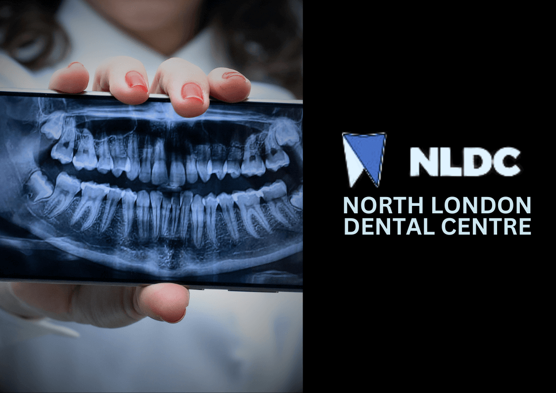 The Benefits of GDC-Approved Dental Radiography Courses for Nurses